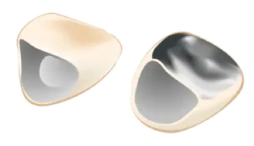 硬質レジン前装冠