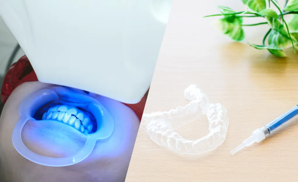 デュアルホワイトニング