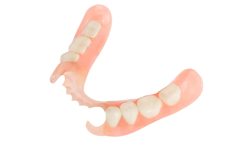 ノンクラスプデンチャー