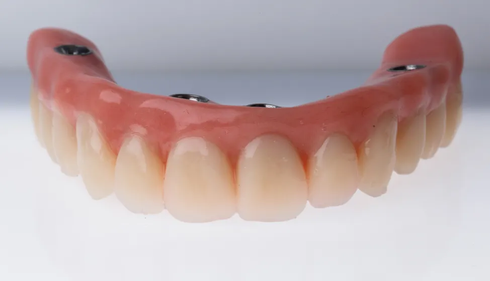 マグネットデンチャー