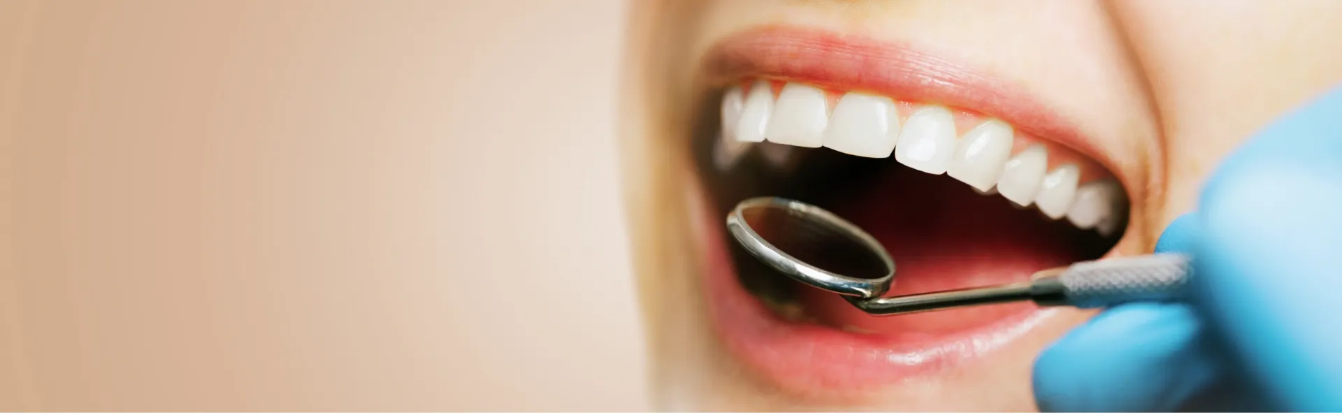 主な虫歯の治療法