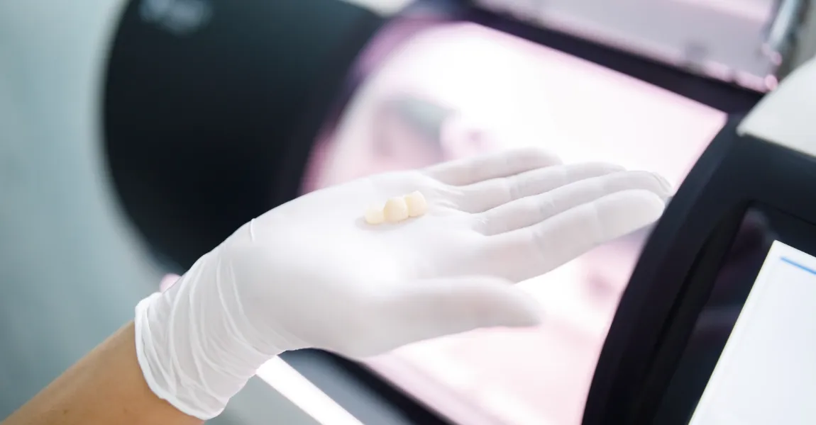 セラミック治療