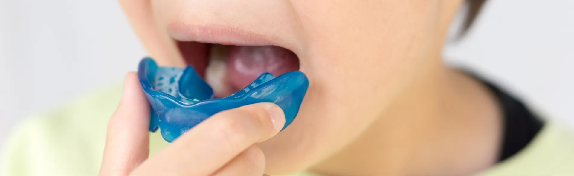 子どものマウスピース矯正「プレオルソ」