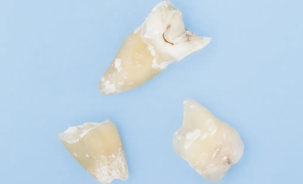 スポーツや事故によるけが・破損