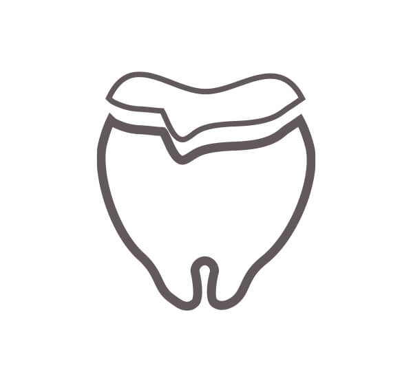 詰め物・被せ物・入れ歯